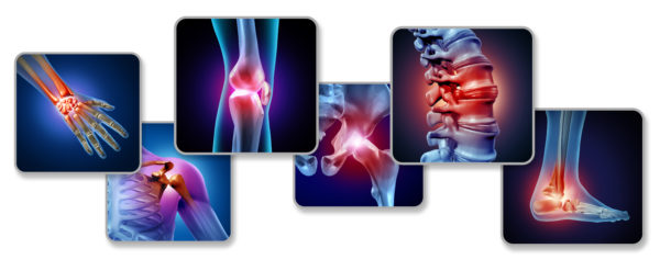 Joint Pain: Causes And Remedies
